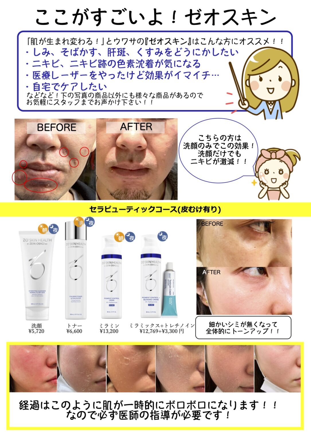 東京銀座販売 【新品】ゼオスキン ZO Skin Health デイリーPD | www